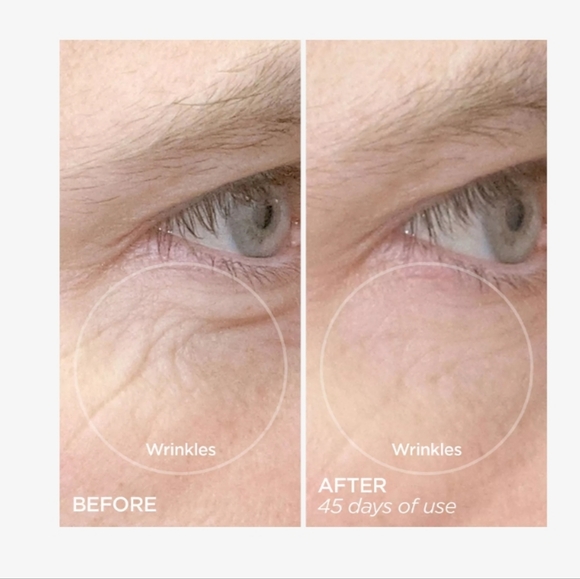 NIB $160 BeautyBio R45 The Reversal 3-Phase Retinol Booster System - Picture 4 of 11